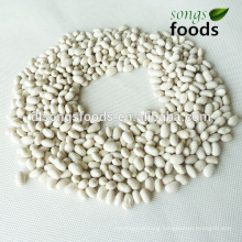 All Kinds of Kidney Beans with High Quality